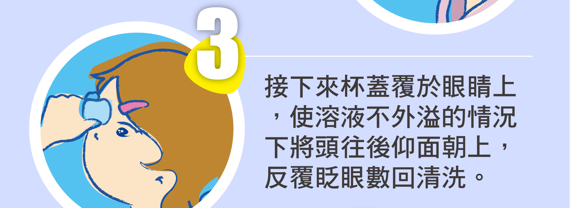 接下來杯蓋覆於眼睛上，使溶液不外溢的情況下將頭往後仰面朝上，反覆眨眼數回清洗。
                            