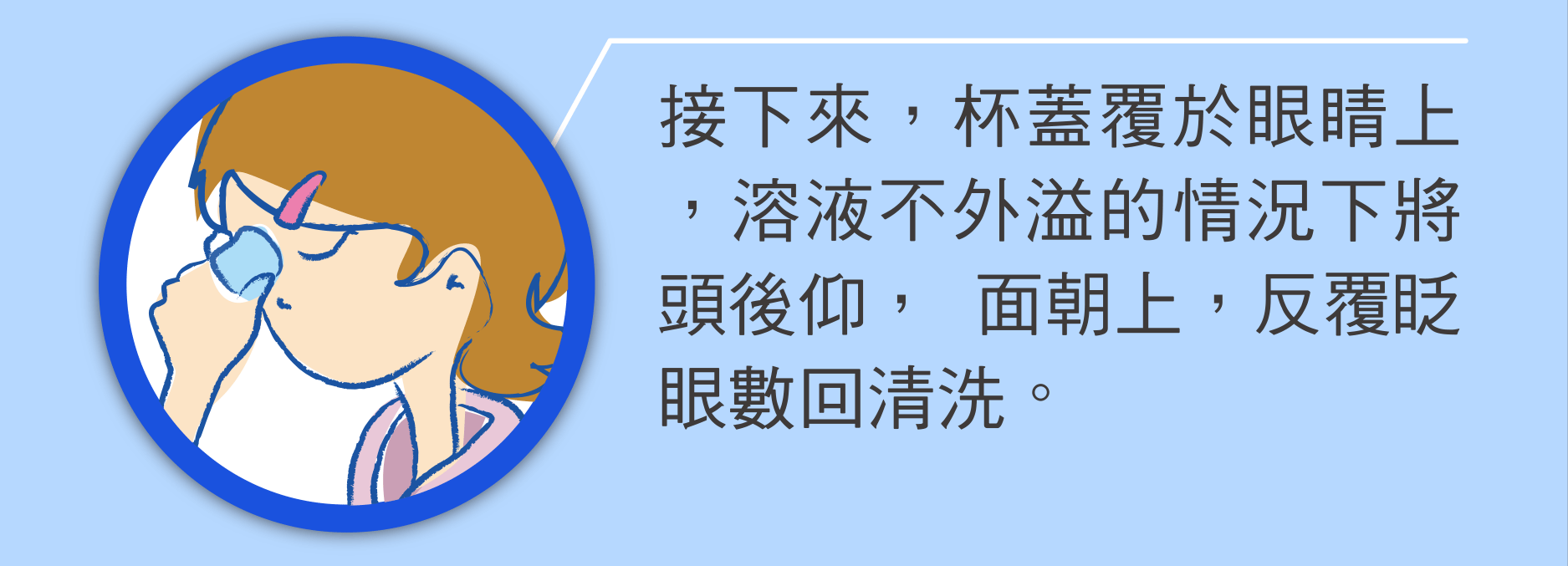 接下來，杯蓋覆於眼睛上，溶液不外溢的情況下將頭後仰， 面朝上，反覆眨眼數回清洗。