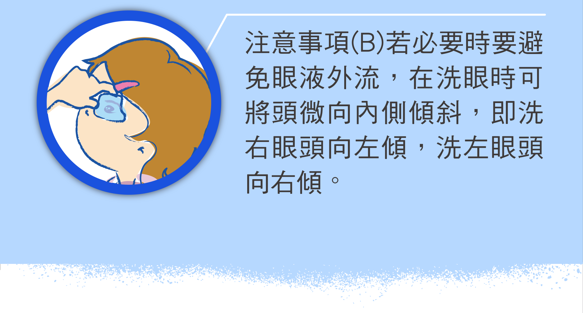 注意事項(B)若必要時要避免眼液外流，在洗眼時可將頭微向內側傾斜，即洗右眼頭向左傾，洗左眼頭向右傾。